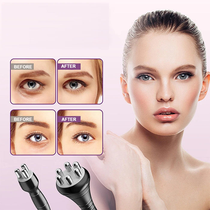 Cavitation Ultrasonic RF Machine for Weight Loss & Skin Rejuvenation