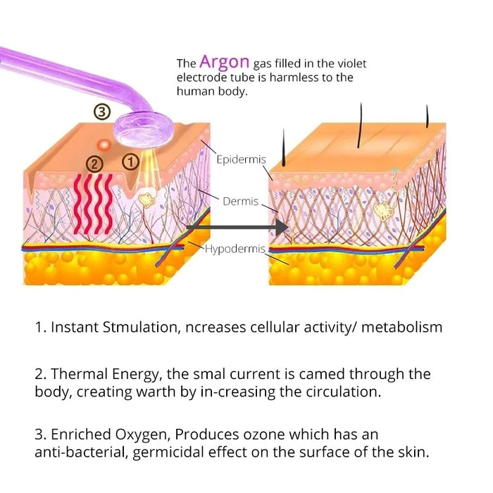 Neon and argon wands offer versatile skin therapy benefits