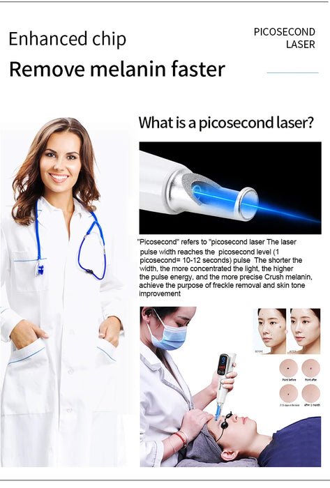 Red light laser pen for acne and pigment treatment