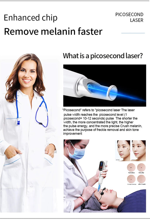 Red light laser pen for acne and pigment treatment