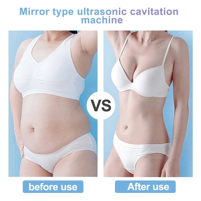 Improves Stretch Marks & Skin Elasticity for a more youthful appearance