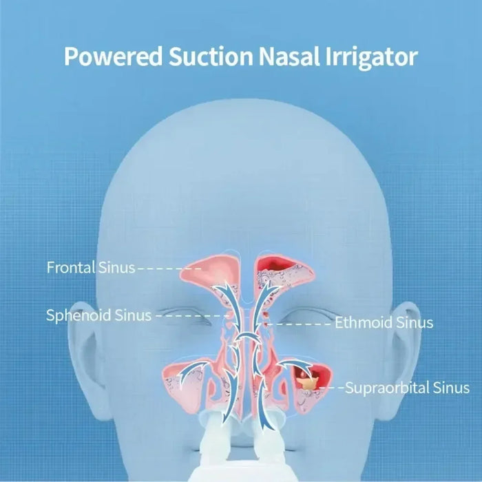 Portable Nasal Irrigator for Adults and Kids with Salt