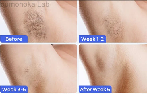 Permanent IPL laser hair remover with 500000 flashes for men and women