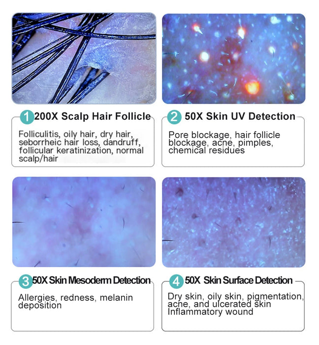 10" HD Skin and Scalp Analyzer with 50X Zoom